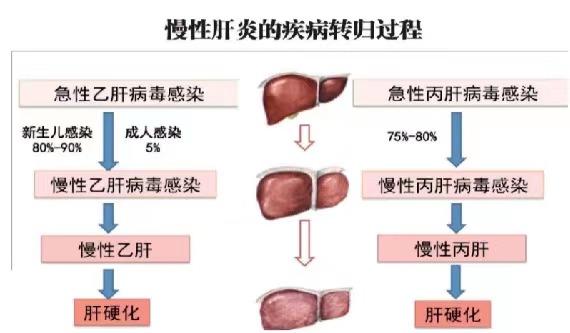 【健康科普】世界肝炎日——堅(jiān)持早預(yù)防，加強(qiáng)檢測發(fā)現(xiàn)，規(guī)范抗病毒治療